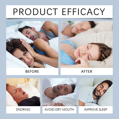 Experience quieter nights with the Silencare Sleep Support Mouthpiece
